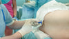 Epidural During Childbirth: Everything Expectant Moms Should Know