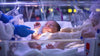 Tips for Premature Babies After NICU Discharge