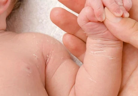 Delicate from Day One