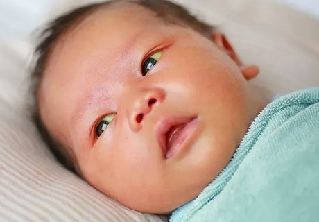 Common Concerns of Delicate Baby Skin